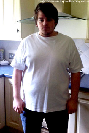 Gastric band hypnosis in Essex- before therapy